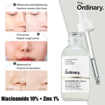 The Ordinary Niacinamide 10% + Zinc 1% Serum 30ml